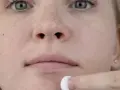 Juckende Gesichtshaut: Die wahren Ursachen & effektive Hilfe